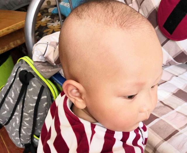 孩子睡觉老是摇头，头发都磨没了，到底是什么原因引起的？