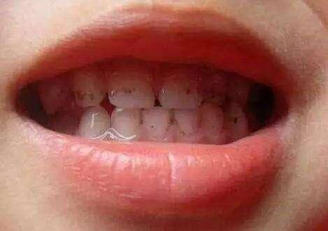 3岁孩子总说牙疼，牙齿却是好好的，医生检查后的画面，吓坏妈妈