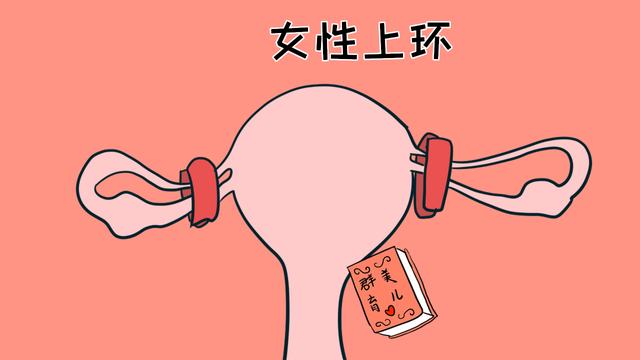 避孕方式你知道哪些？女性上环和男性结扎，哪个对身体好？