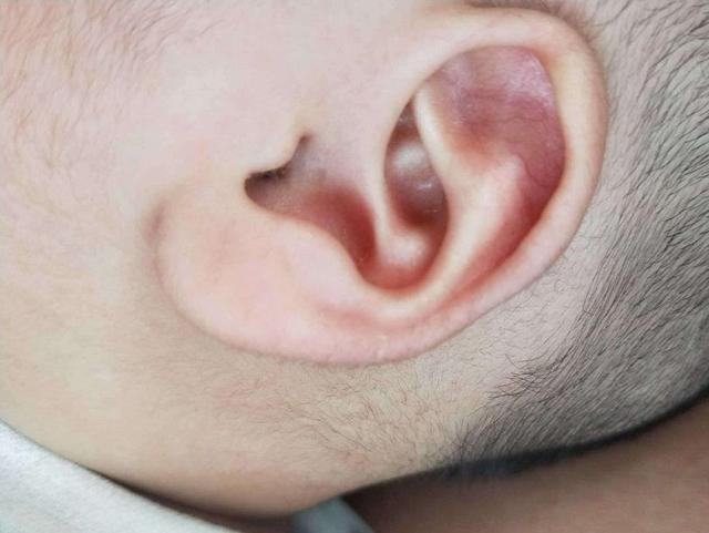 孩子睡觉老是摇头，头发都磨没了，到底是什么原因引起的？