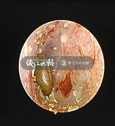 游乐场出事了！杭州2岁宝宝连看4家医院，差点全麻手术！这项目你家娃也爱玩