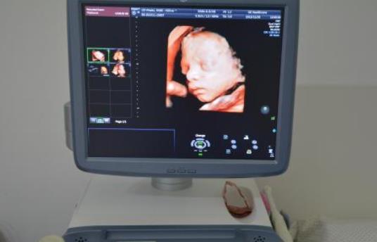 孕妈做“四维彩超”之前，最好了解3件事，多花冤枉钱