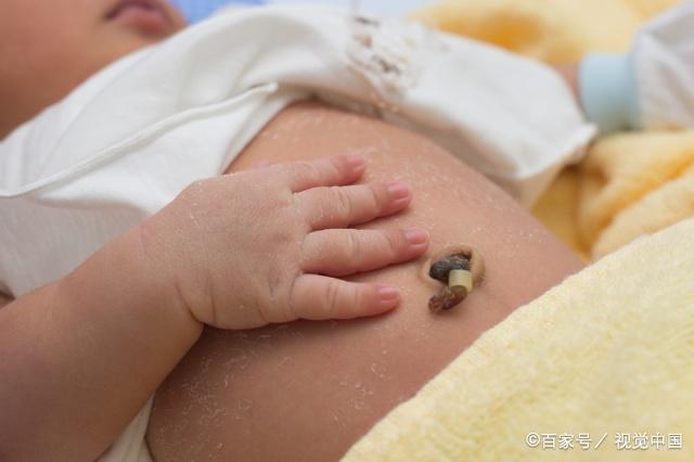宝宝出生后，在护理方面，妈妈关心的4个问题都在这了！