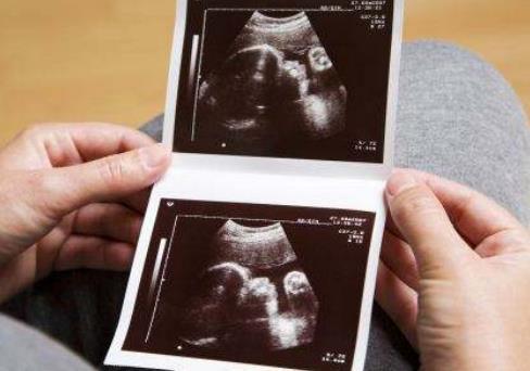 孕妈做“四维彩超”之前，最好了解3件事，多花冤枉钱