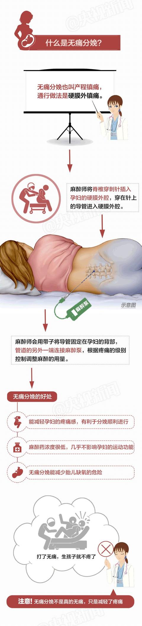 “生孩子顺产还是剖腹产好？不要纠结，一张图告诉你……