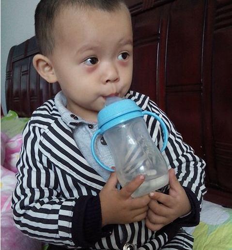 孩子体内有没有积食？看这5点很关键，脸上不会说谎，一看就知道
