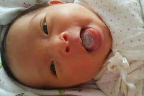 宝宝脾胃不和，都在脸上写着呢，若有这3个变化，家长要注意