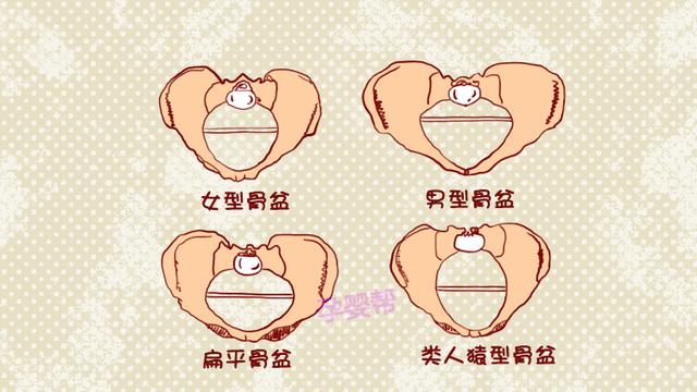 女性的这3种习惯，易导致骨盆歪斜影响分娩，特别第3种最难防