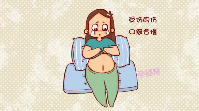 符合这种条件的孕妈，最好不要选择剖腹产，对你和胎儿都不好