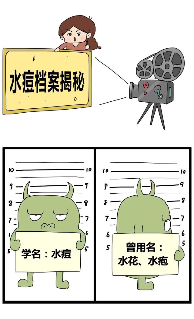 换季别忘战“痘”，宝宝得了水痘怎么办？关于水痘你还知道多少？