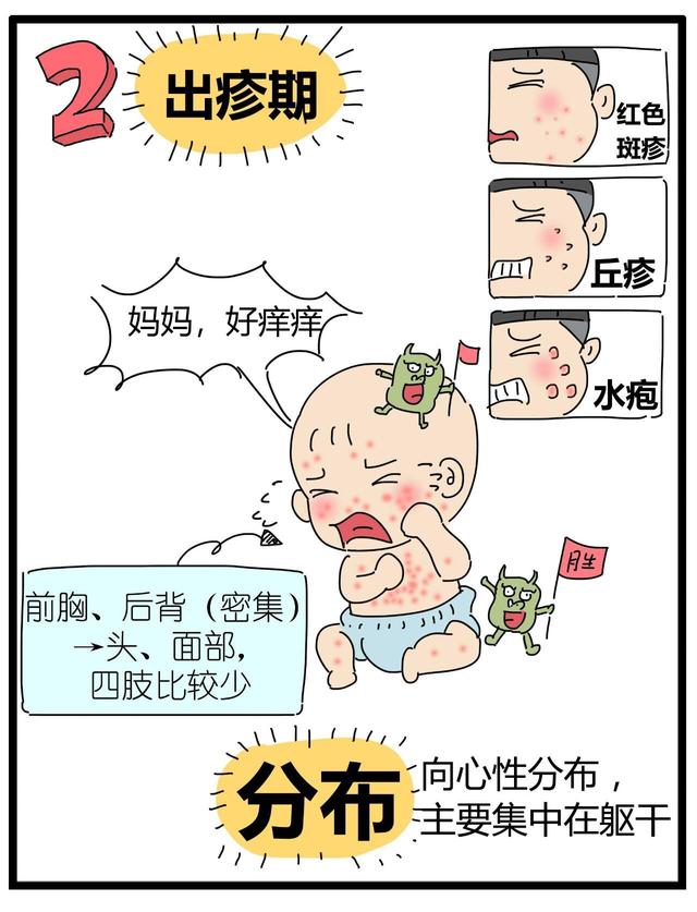 换季别忘战“痘”，宝宝得了水痘怎么办？关于水痘你还知道多少？