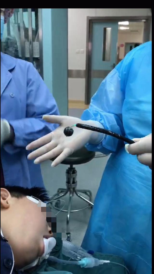 男孩嘴含铁球玩，咕噜一声咽了！家长卫生间连盯4天，球没找着…