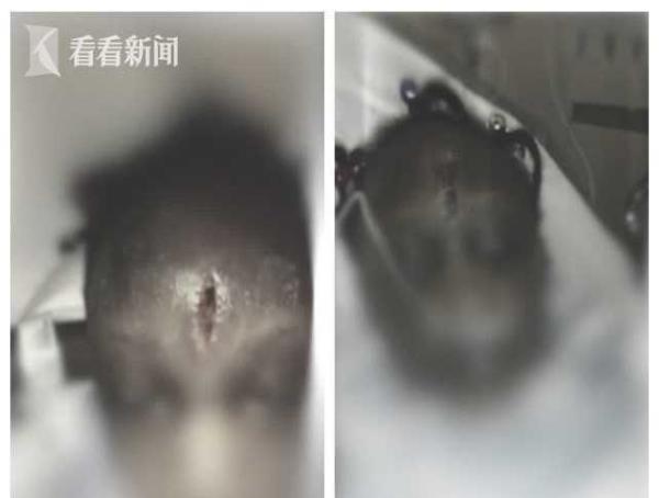 3岁女童被老师拎着胳膊扔飞 头撞柜子开裂缝7针