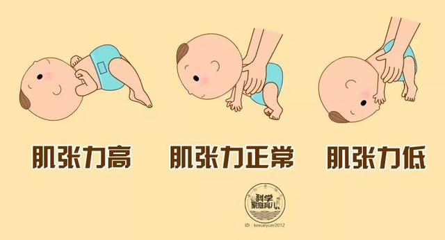宝宝四肢紧、易受惊，是胆小么？别大意尽快筛查肌张力！