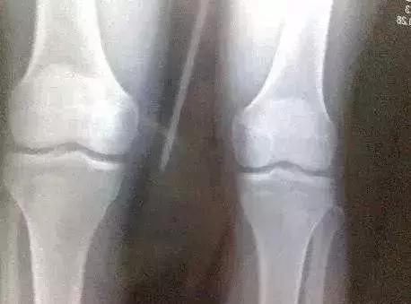 这件导致孩子长不高的事，请别再做了！
