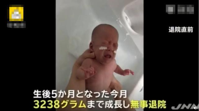 世界上最小的男婴平安出院，出生时仅268克