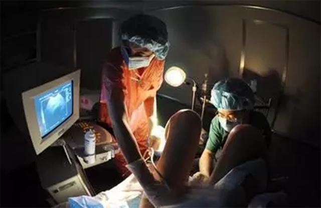 试管婴儿是如何做到的？看完整个过程后，网友：看着都痛！