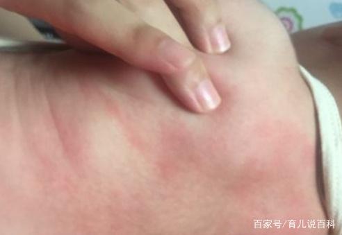 孩子身上这几个部位，家长再生气也不能打！