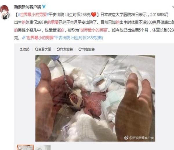 奇迹！“世界最小的男婴”平安出院 出生时体重仅268克