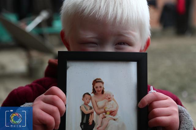 白化病男孩想妈妈时对着照片哭，奶奶送他上学，经常被人指指点点