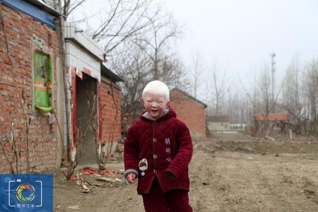 白化病男孩想妈妈时对着照片哭，奶奶送他上学，经常被人指指点点