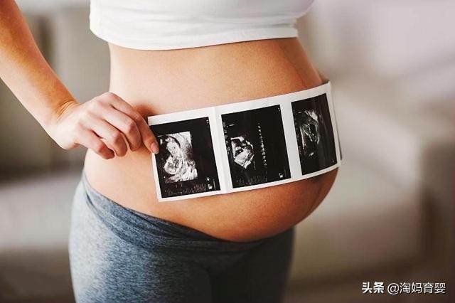 四维彩超检查，胎儿总挡脸？可能是胎儿在做这3件事
