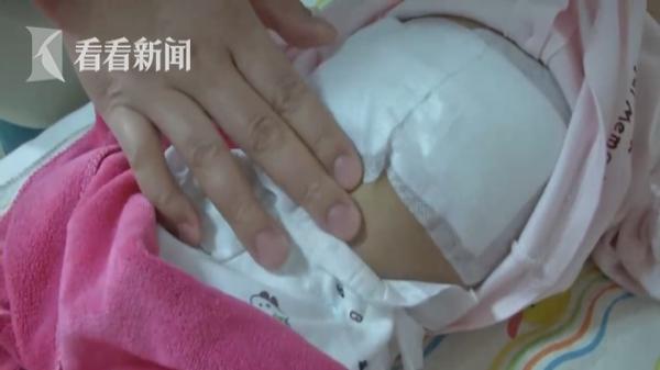 出生100天女婴体重12斤！看了眼肚子 父母崩溃了