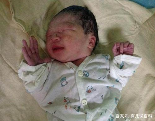 新生儿能有多“丑”？网友晒出前后对比图