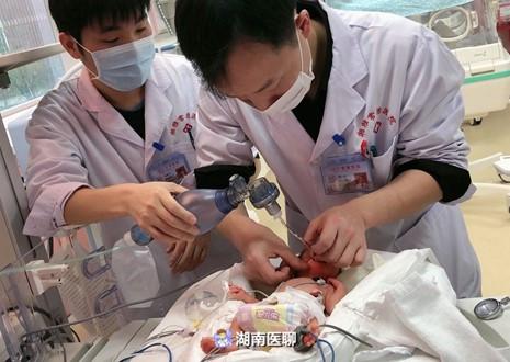 早产龙凤胎“生存记”：出生仅巴掌大！2个月连闯多个生命关逆袭