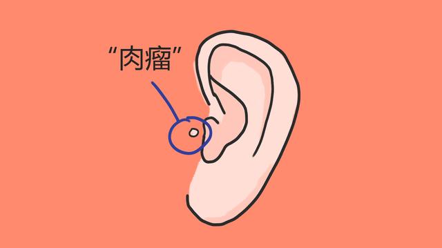 隐蔽的先天畸形有很多，宝宝耳朵处易出现，妈妈别胡乱护理！