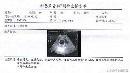 孕期到底要做几次B超？B超有辐射吗？那些英文字母到底代表什么？