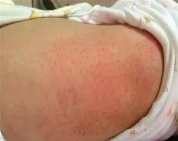 新生儿身上长满黑色“毒刺”，只因奶奶的一个善意举动