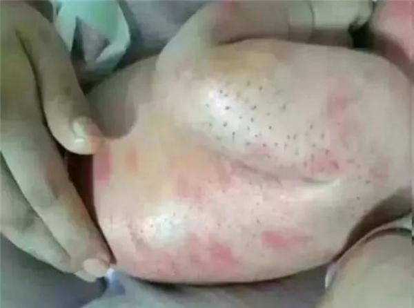 新生儿身上长满黑色“毒刺”，只因奶奶的一个善意举动