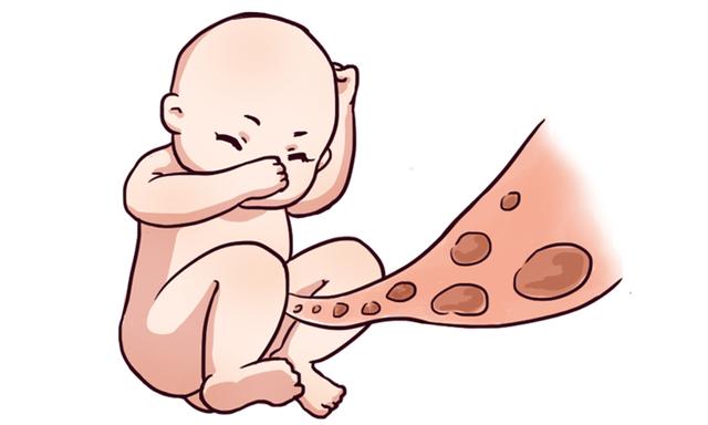 女人十月怀胎，那宝宝的排泄物去哪了？妈妈听后脸色都变了！