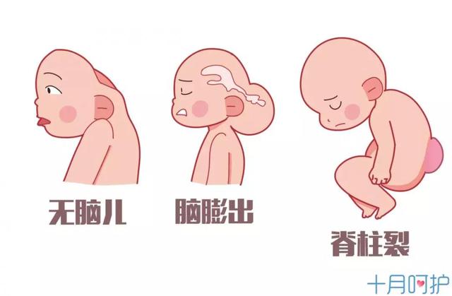 按时产检宝宝出生却少六根指头，医院称自己没责任！