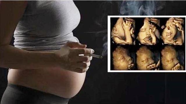 孕期抽烟对胎儿的影响有多大，3张彩照让人心疼，还不够警醒吗！
