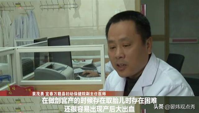 江西“双子宫”产妇生下双胞胎 几率百万分之一