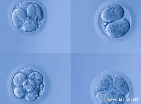 1988年中国第一个试管婴儿！一晃过去30年，曾经的婴儿现在怎么样