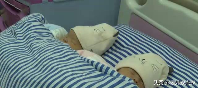 江西“双子宫”产妇生下双胞胎 几率百万分之一