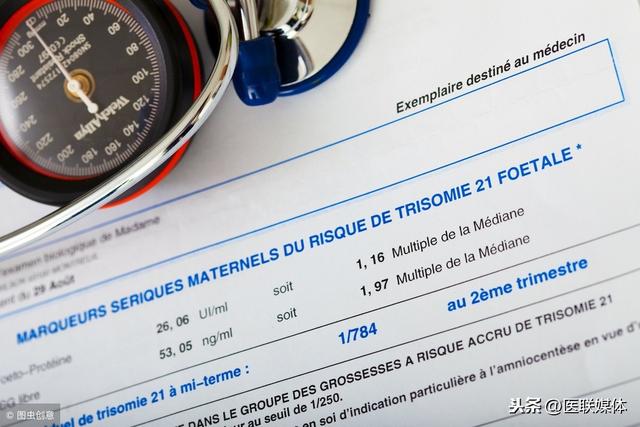 在唐筛高风险的情况下，无创通过率高吗？答案似乎很显然