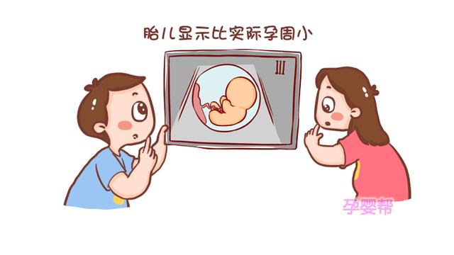准妈孕检遇孕囊暗区先别慌，是否属于流产，还是取决于这一点