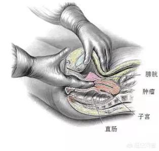 内检真的有那么恐怖吗？