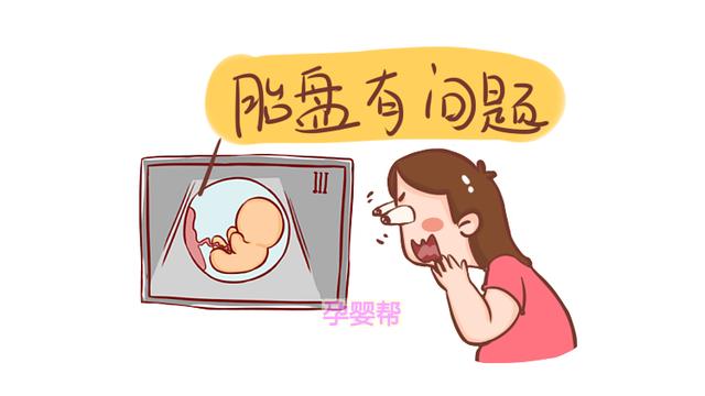 符合这3个条件的准妈，孕期不建议做“那件事”，易致胎儿流产