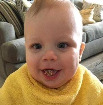 男孩舌头异常肥大险些致命，手术成功终于能叫妈妈！