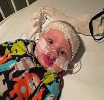 男孩舌头异常肥大险些致命，手术成功终于能叫妈妈！