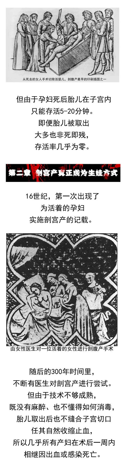 剖宫产这一刀在哪划？划多大？怎么缝？都是很有讲究的
