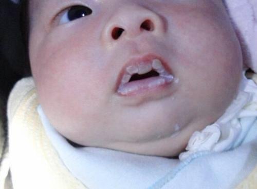 3天新生儿喝母乳后就去了医院，医生检查后发现，还是妈妈惹的祸