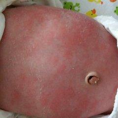 新生儿7个看似异常、其实正常的生理现象,你知道几个?建议收藏