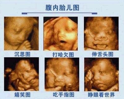 怀孕几周去做四维彩超比较好？去做四维彩超前，孕妈应注意什么？