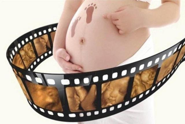 怀孕几周去做四维彩超比较好？去做四维彩超前，孕妈应注意什么？
